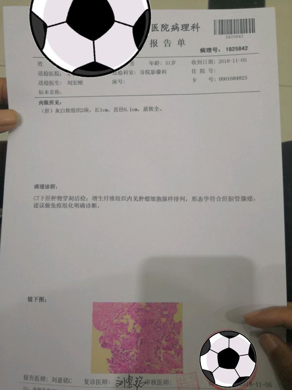 我爸爸肝胆管腺癌还有一个小的大的9*7.7