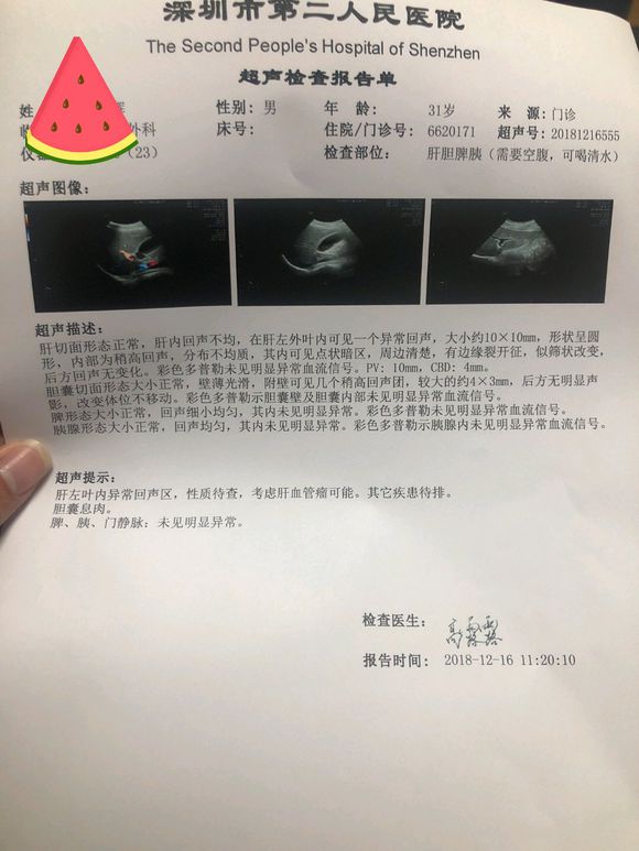 吧友们，帮忙看看，右上腹疼痛3个月了，拉肚子！