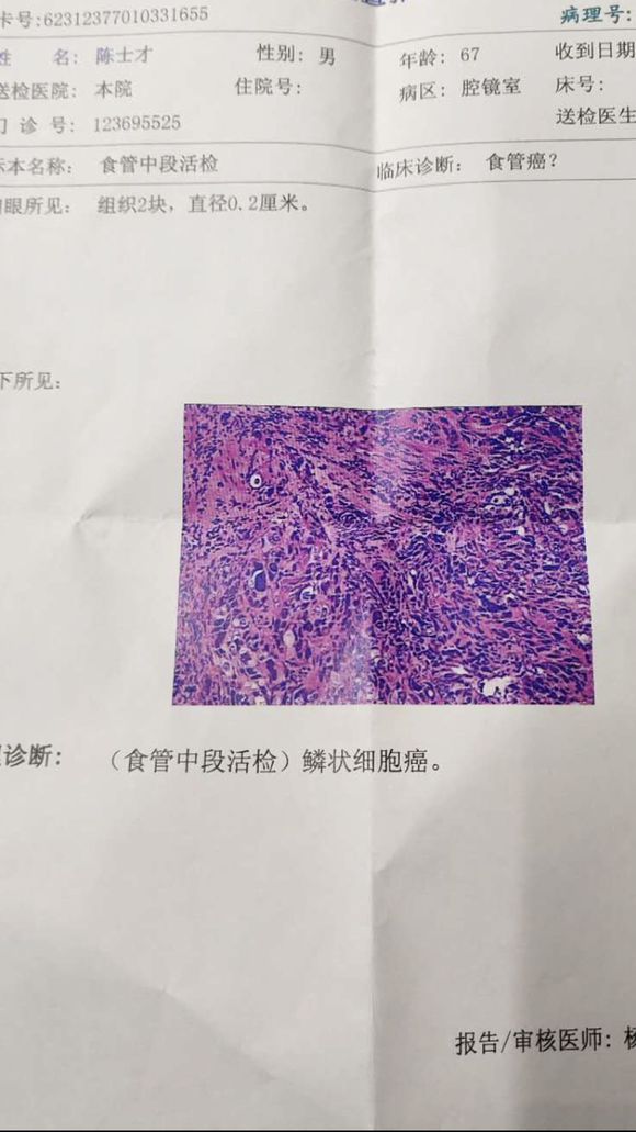 父亲检查结果出来到今天我都一直瞒着他们老两口