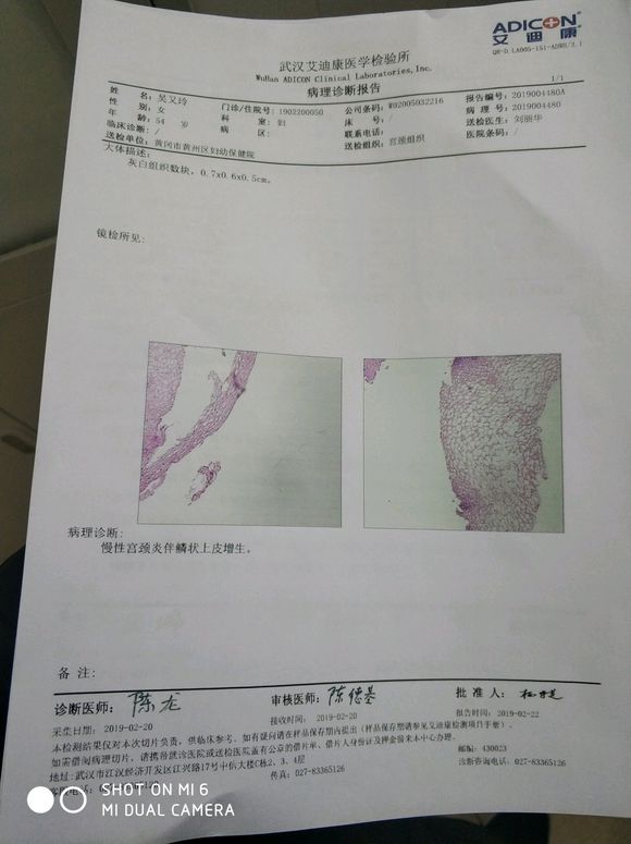 有懂妇科的人吗？宫颈之类的，我妈妈的检验报告