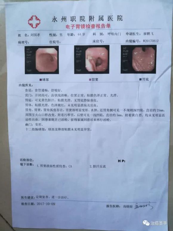 我岳父大人的胃癌有没有更好的治疗方案
