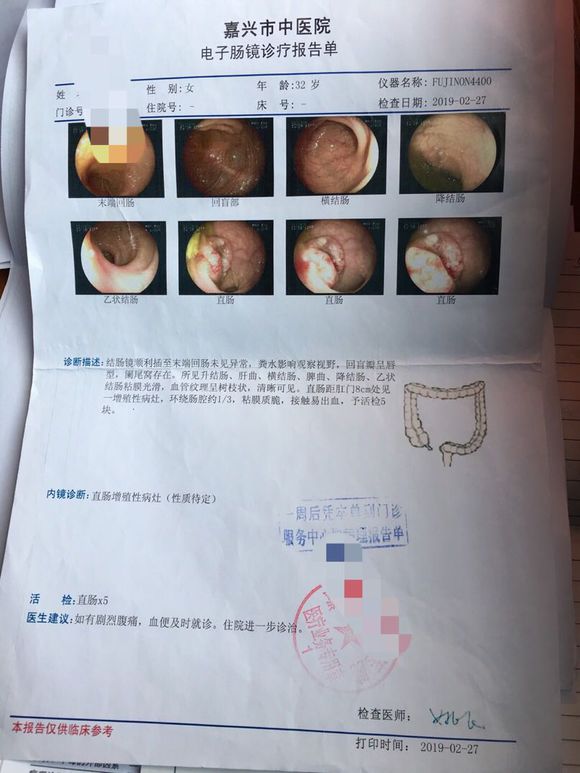 年前开始有点便血，去了医院做了指检