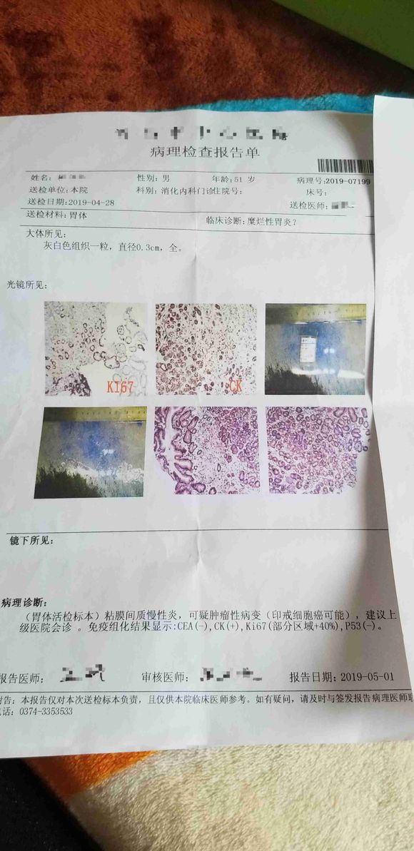 最近刚检查出来的，觉得接受不了。
