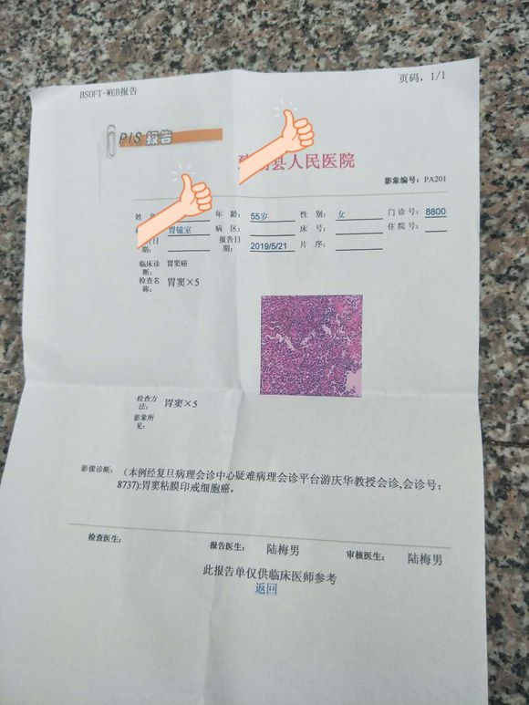 妈妈才55周岁这几天被确诊为胃印戒细胞癌