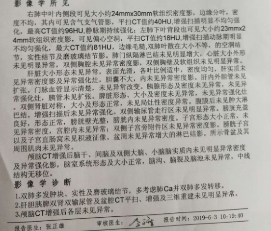 我的妈妈5月检查出来的肺癌晚期