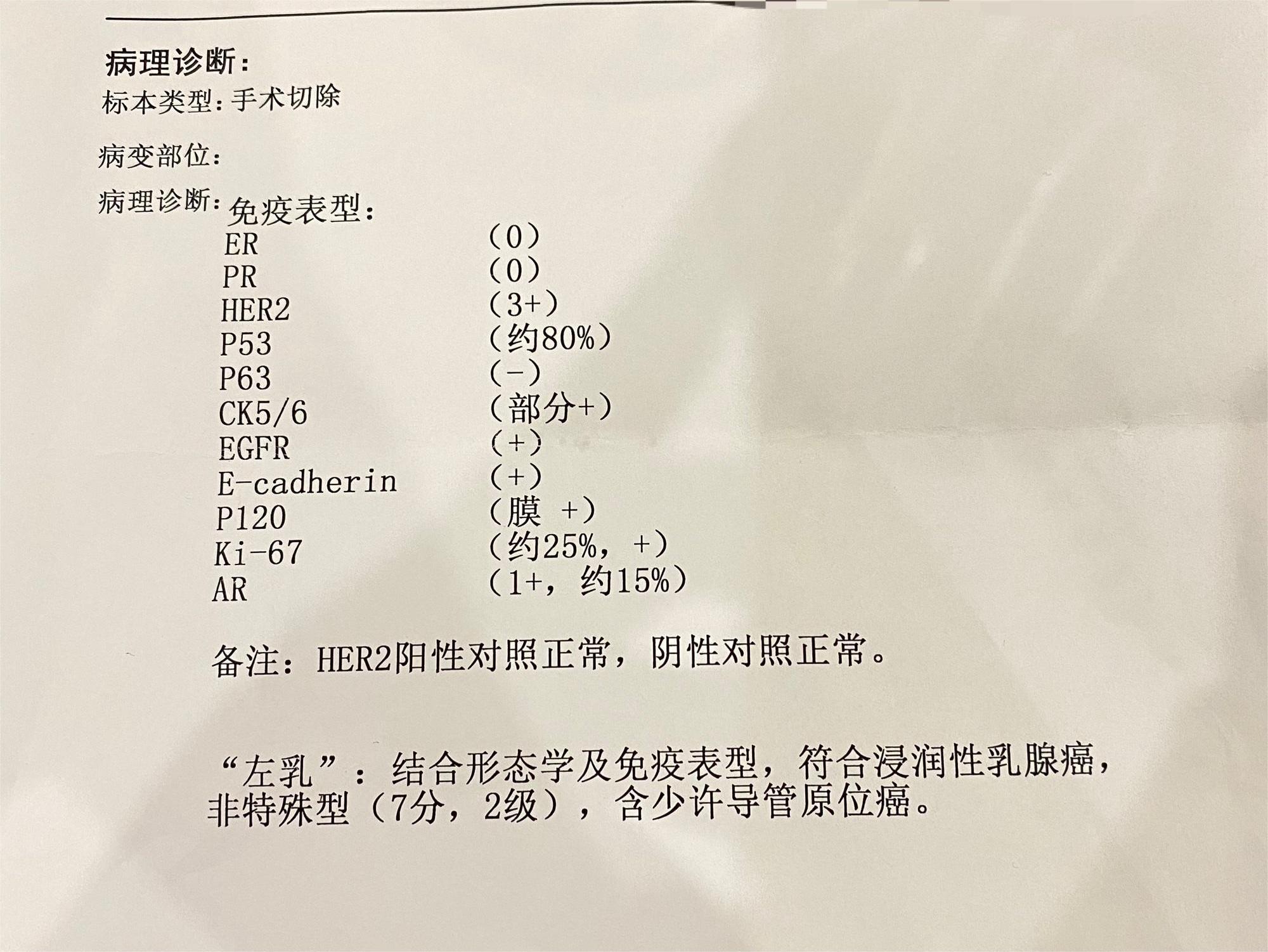 《浸润性乳腺癌》求组各位