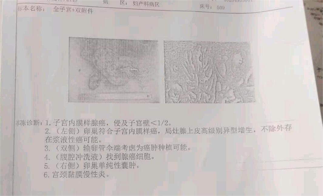 求帮忙看一下这是晚期了吗