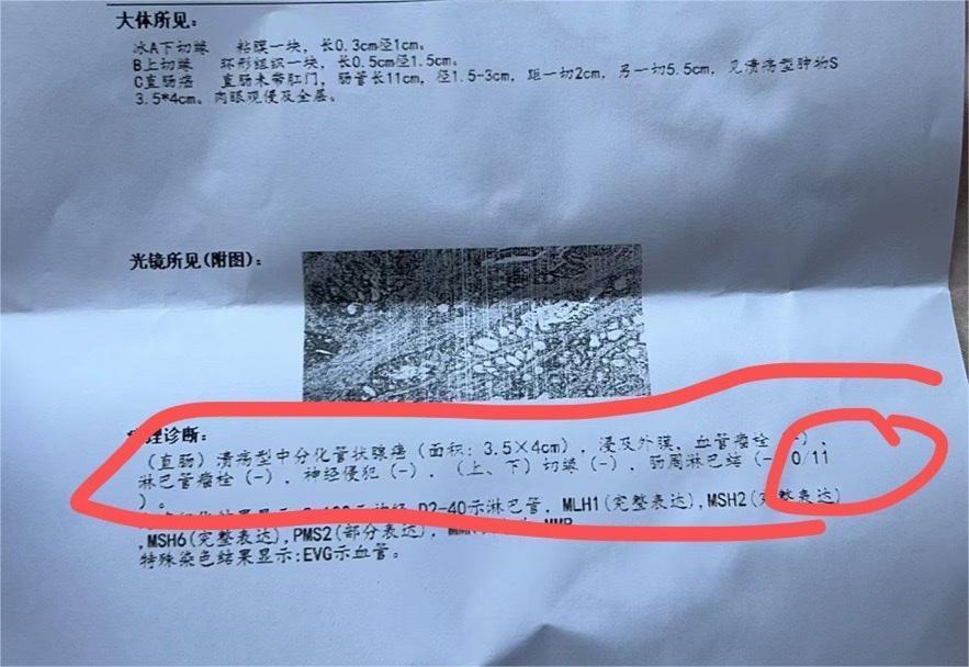 大家帮忙看看需要化疗吗